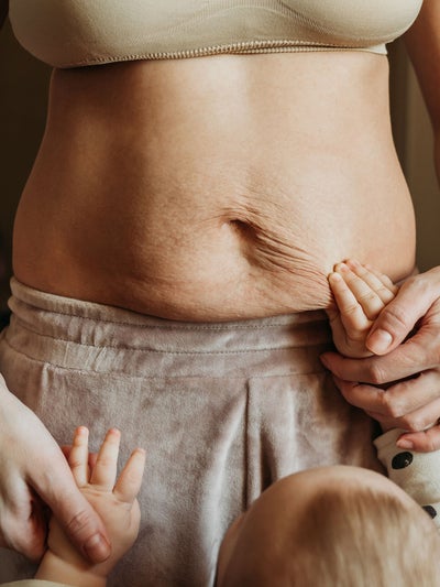 Little baby's hands on woman's belly full of stretch marks after pregnancy.